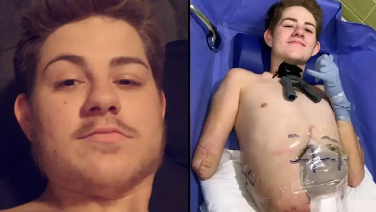 Man Cut In Half By Forklift Makes Heartbreaking Confession About His Life Since Accident