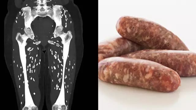 Horrifying scan shows what could happen to your body when you undercook your pork sausages