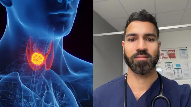 Doctor explains easily missed symptoms of cancer that was ‘very rare’ but now on the rise