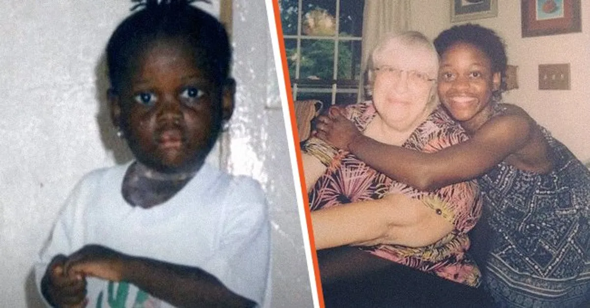 Girl Rejected for Her Looks Is Adopted by Mom Who Lost 3 Kids — She Becomes a Famous Performer