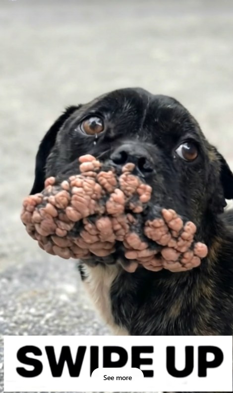 What Really Causes Acne? The Truth Behind Breakouts