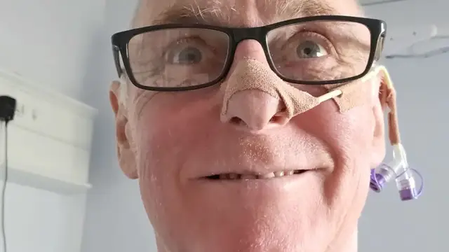 Man diagnosed with throat cancer ‘surprised’ to learn it was caused by oral sex