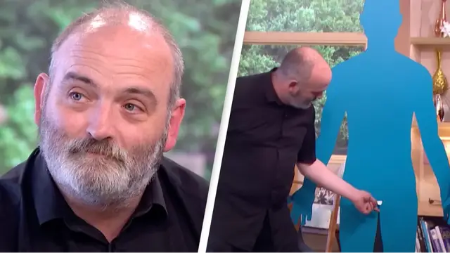 Man with one-inch penis opens up about life with a micropenis